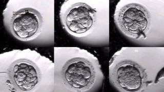 IVF PROCESS STEP BY STEP In Vitro Fertilisation Embryo cultivation [upl. by Airelav300]