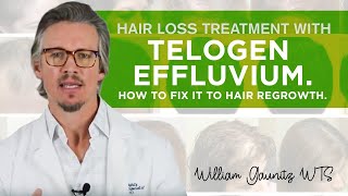 Telogen Effluvium Hair Loss  What is it How To Fix It Fast [upl. by Wirth]