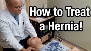 Hiatal Hernia Relief Technique [upl. by Gathard]