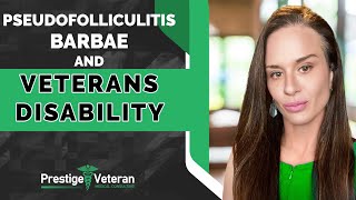 Pseudofolliculitis Barbae and Veterans Disability  All You Need To Know [upl. by Nelo]