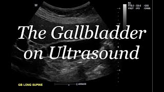 THE GALLBLADDER ON ULTRASOUND [upl. by Rawley]