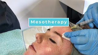 Mesotherapy With Anna [upl. by Aihcsrop]