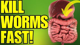 20 EASY Ways to Get Rid of Intestinal Worms and Parasites from Your Body [upl. by Brocklin]