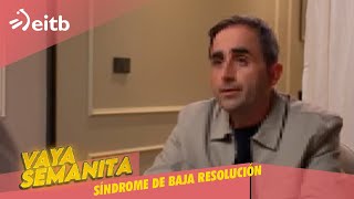 VS Síndrome de baja resolución vayasemanita [upl. by Fasto]