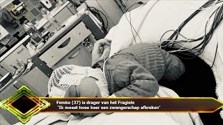 Femke 37 is drager van het Fragiele ‘Ik moest twee keer een zwangerschap afbreken’ [upl. by Clarissa]