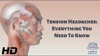 Tension Headaches Everything You Need To Know [upl. by Sura]