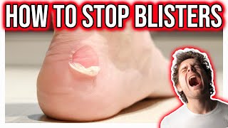 Blister Prevention How to STOP blisters [upl. by Hannasus]