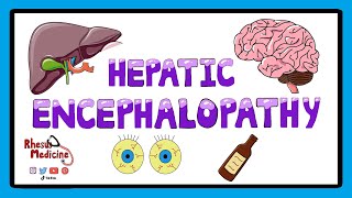 Hepatic Encephalopathy  Pathophysiology Stages and West Haven Criteria [upl. by Wistrup]