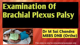 Examination of Brachial Plexus Palsy [upl. by Reece591]