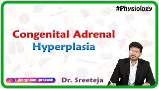 Congenital Adrenal Hyperplasia  USMLE Step 1 [upl. by Erroll]