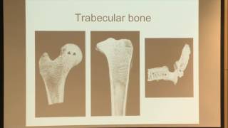 11 Trabecular Bone and Osteoporosis [upl. by Groeg167]