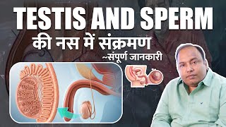 Testis में infection का होना  क्या है इसकी मुख्य वजह लक्षण और इसका इलाज [upl. by Shawnee]