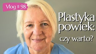 98 PLASTYKA POWIEK GÓRNYCH PRZED I PO moja opinia efekty i czy warto👁️✨ [upl. by Salomon145]