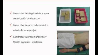 umh1723 201213 Lec015a Electrodiagnóstico de estimulación Metodología de las curvas I  t [upl. by Ellehcar]