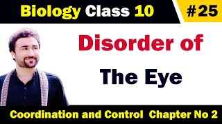 Disorder of eye class 10 biology  short sightedness and long sightedness explained in urdu [upl. by Yreme]