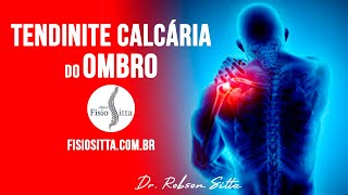 DOR no OMBRO TENDINITE CALCÁRIA CAUSAS e TRATAMENTO de FISIOTERAPIA  Fisioterapia Dr Robson Sitta [upl. by Ihskaneem720]