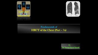 HRCT chest for Radiology Residents  Part 7a  Mosaic Pattern [upl. by Lrem]