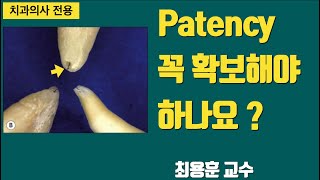 Patency 에 대해 솔직히 말씀 드립니다 1회신경치료 치아살리기 플라젠 판교최용훈치과 [upl. by Katt]