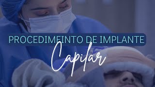 Mejor clínica capilar en Colombia¿Cómo es un procedimiento de implante Capilar con Mediarte [upl. by Lexie]