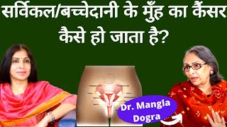 Cervical Cancerबच्चेदानी के मुँह के कैंसर के बारे में पूरी जानकारी कैसे होता है कैसे बच सकते हैं [upl. by Scully]