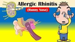 Allergic Rhinitis Runny Nose  Causes Triggering Factors Signs amp Symptoms And Treatment [upl. by Golter]