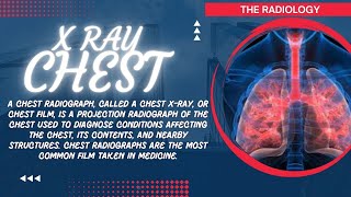 X Ray Chest Anatomy Uses Causes [upl. by Mikes]