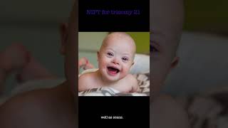 NIPT l Does NIPT help diagnose Down syndrome NIPT [upl. by Utica]