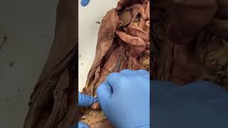 Abdominal Arteries and Veins of a cat [upl. by Nylsirk907]