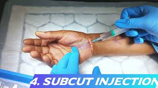 StepbyStep Guide Administering Local Anaesthesia for Carpal Tunnel Decompression [upl. by Osborn]