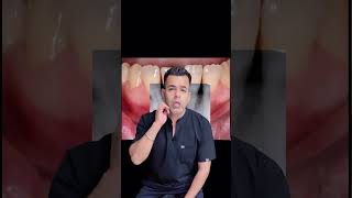 5 signs of severe pulp infections  Discovering the dangers of pulp infections delhidentist [upl. by Egiedan]