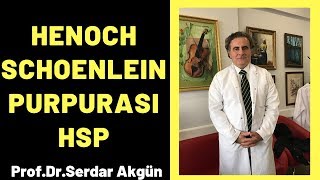 Henoch Schonlein Purpurası HSP Serdar Akgün [upl. by Luna651]