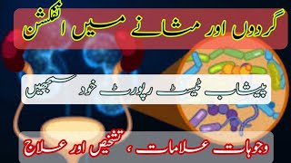 UTI  Urinary tract infection  Hindi Urdu  Causes  Symptoms  Diagnosis  Treatment  Ultrasound [upl. by Maidy]