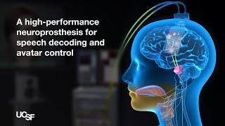 A Neuroprosthesis for Speech Decoding and Avatar Control  Chang Lab  UCSF [upl. by Edecrem98]