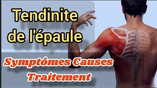 Tendinite de lépaule Causes symptômes traitement efficace Soulager Exercices coiffe des Rotateurs [upl. by Cann]