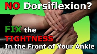 NO Dorsiflexion Fix the TIGHTNESS In the Front of Your Ankle Fix Tight Ankles Part 1 [upl. by Adao26]