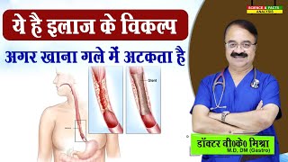 ये है इलाज के विकल्प अगर खाना गले में अटकता है  DYSPHAGEA DIFFICULTY IN SWALLOWING TREATMENT [upl. by Dorman]