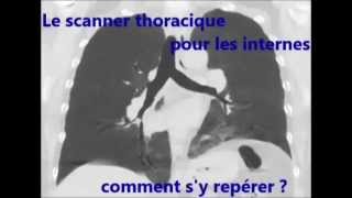 Les bronches en scanner pour les internes [upl. by Romain]