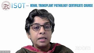 POST RENAL TRANSPLANT VIRAL INFECTIONS  Dr Anila Abraham Lec 10 [upl. by Zetrac659]