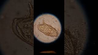 Schistosoma mansoni from my lab بويضة بلهارسيا [upl. by Rodie]