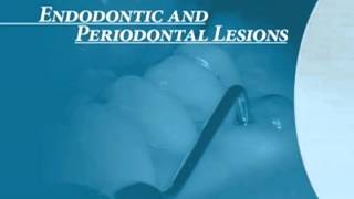 Endodontics Torabinejad 60 Endo Perio Introduction [upl. by Prowel]