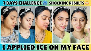 7 Days Challenge 🔥 I Applied ICE on my Face amp This Happened challenge iceonface skincare [upl. by Ikeda]