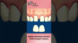 Best dentist near me Park dental clinic dwarka  Dr Neetu singh 8171171699 [upl. by Bearce]