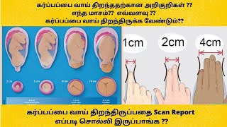 cervical dilation chart in tamil  Cervix dilation symptoms tamil  cervix dilation pain in tamil [upl. by Gassman]