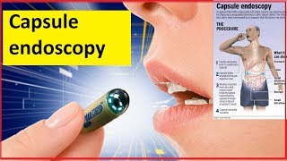 Capsule endoscopy [upl. by Carolus]