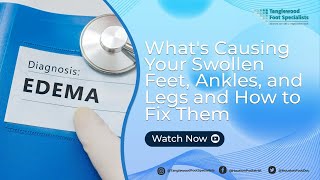 Whats Causing Your Swollen Feet Ankles and Legs and How to Fix Them [upl. by Ymmak874]