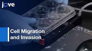 Cell Migration and Invasion [upl. by Yelreveb]