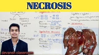 NECROSIS  cell injury  general Pathology Hindi [upl. by Amaso]