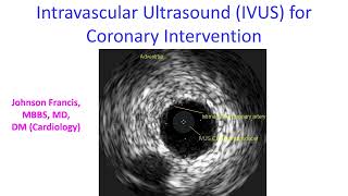 Intravascular Ultrasound IVUS for Coronary Intervention [upl. by Danika656]