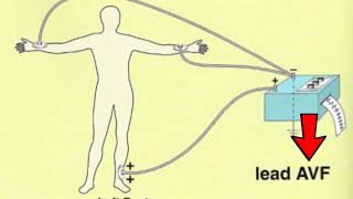 🔴 LES 12 DÉRIVATIONS ECG EXPLIQUÉES TRÈS CLAIREMENT  DR ASTUCE [upl. by Warrenne]