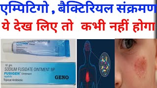 Fusigen Ointment sodium fusidate in hindi Use Profit Sideeffects by offlineboymedico [upl. by Kegan]